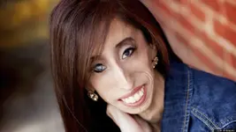 "Người phụ nữ xấu xí nhất thế giới" trở thành nguồn cảm hứng sống