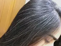 4 nguyên nhân khiến tóc bạc nhanh và cách khắc phục