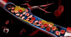 Những loại lá giúp giảm cholesterol, tốt cho tim mạch